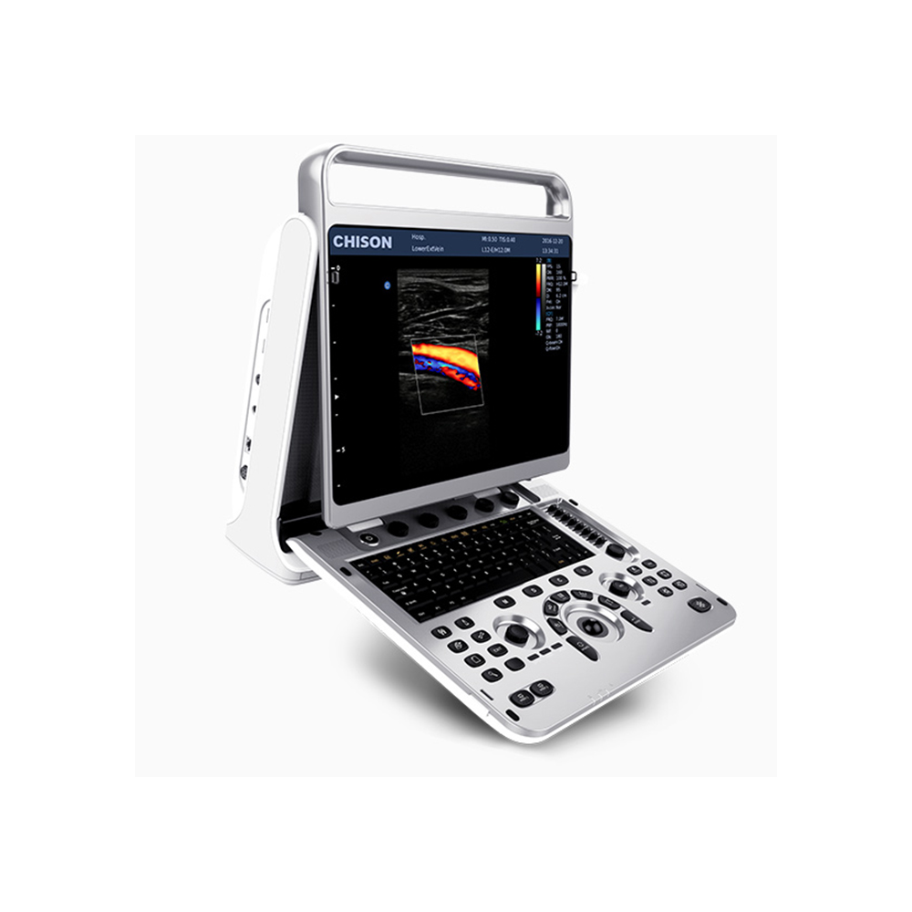 CHISON EBit 20 VET Farb-Doppler-Ultraschallger&auml;t