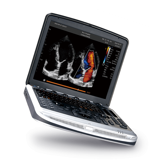 CHISON SonoBook 7 VET Farbdoppler-Ultraschallger&auml;t