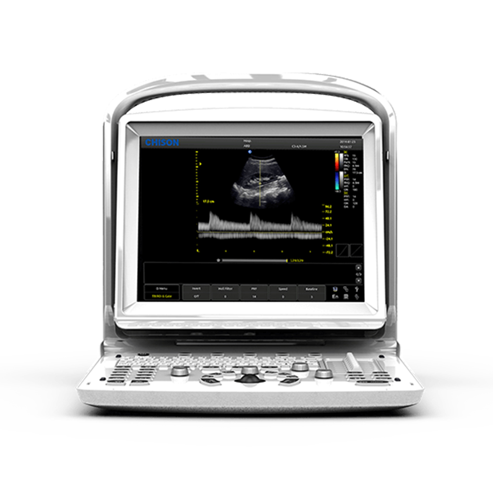 Chison ECO 3 Expert VET Doppler-Ultraschallger&auml;t